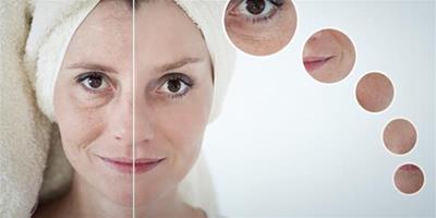 閉合性痤瘡怎麼治療 輕鬆四招護膚技巧助你恢復美麗容顏