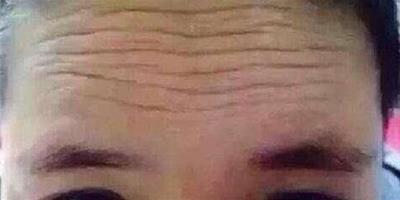 女人皺紋怎麼減少 教你如何正確去除抬頭紋