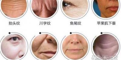 額頭長皺紋是什麼原因 有助於幫助去皺紋的方法