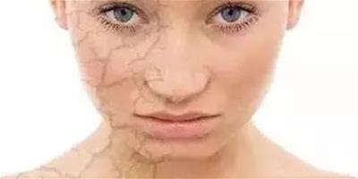 春季敏感肌護膚 應該注意的護膚事項