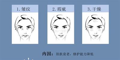 面部除皺的方法有哪些？教你專業去除皺紋的方法