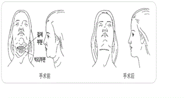 頸部有皺不可怕 定期保養要做到