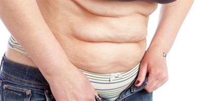 肥胖嚴重影響健康 如何做到科學減肥