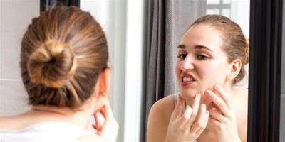 淡化黑色痘印有效的方法 恢復臉蛋光滑