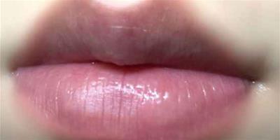 豐唇有硬塊什么原因 豐唇硬塊會消失嗎