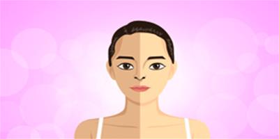 臉上油性皮膚怎么改善 油性皮膚的特點