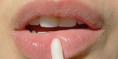 嘴唇敏感用什么唇膏，Blistex百蕾適柔護唇膏，秋冬專用