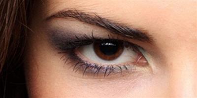 遺傳性眼袋怎麼去除？ 4個物理治療法讓你擁有明亮雙眸