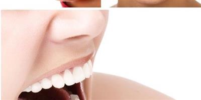 為什麼要牙齒整形 牙齒畸形的危害