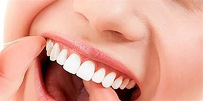 什麼是四環素牙和氟斑牙 小編告訴你6個方面要注意