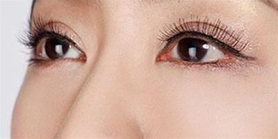 眼部埋線恢復過程圖 告訴你其護理方法讓你擁有美麗大眼睛