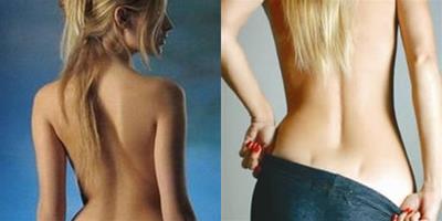 女性有腰窩意味著什麼 一定代表著腎虛嗎？
