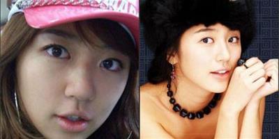 韓國女星整容 清純臉變木偶臉