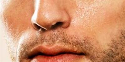 男人應對唇部乾裂的有效小方法