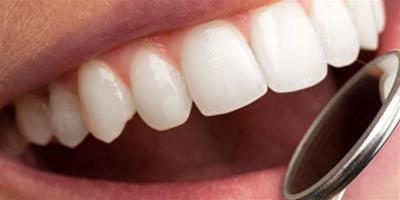 在家怎麼美白牙齒最有效呢 教你如何快速美白牙齒
