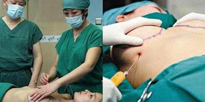 抽脂注射隆胸有效嗎 抽脂手術五大風險