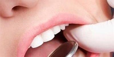 補牙和牙套的過程是怎樣的 8個步驟讓你瞭解整個過程