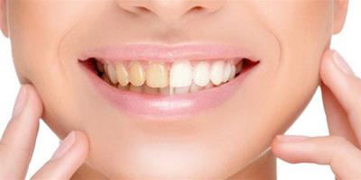 花生美白牙齒小竅門有哪些？ 推薦四種方法教你美白它
