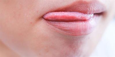 冬天嘴唇乾裂脫皮原因 這5個壞習慣導致