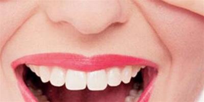 牙發黃怎麼辦 6個快速美白牙齒方法分享