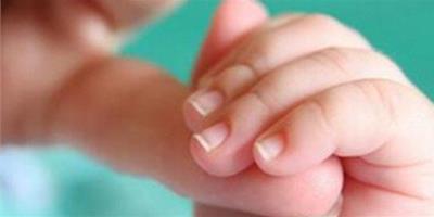 指甲軟 3種現象及方法幫你有效預防和治療