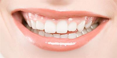牙膏裡放小蘇打能美白牙齒嗎 白牙讓你笑起來更加自信