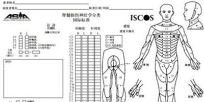 肌力分級的評定標準是什麼 專家讓你一清二楚