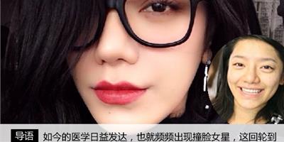 快女江映蓉撞臉範冰冰or楊穎 被疑做過整容手術？