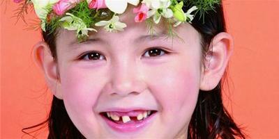 什麼是牙齒整形 孩子牙齒正畸的誤區