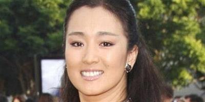 圖揭15位女星容貌變殘 大餅臉雷人雙下巴