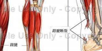 韌帶斷裂還能走路嗎 術後注意休息才能走路