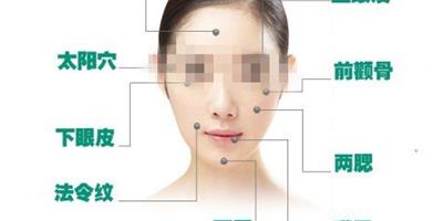 面部脂肪填充前後圖片 手術有這十大風險你知道嗎？