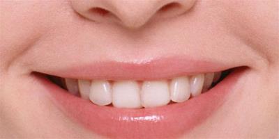能使牙齒變白的方法有哪些 7個小妙招還你自信笑容