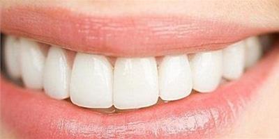 如何迅速美白牙齒 教你4種快速美白牙齒方法