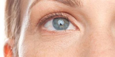 怎麼增加眼眶內脂肪？ 有效方法讓你擁有迷人電眼