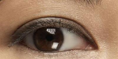 眼皺紋怎麼消除呢 教你擺脫眼皺紋的煩惱