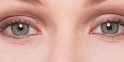 眼睛浮腫的原因是什麼 喝水可以甩掉浮腫金魚眼