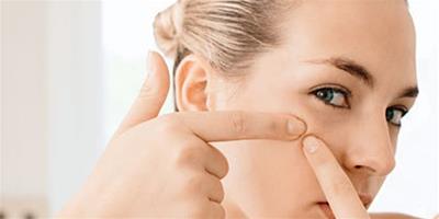 鼻子和臉交接處長痘痘原因是什麼 瞭解臉部不同區域長痘原因