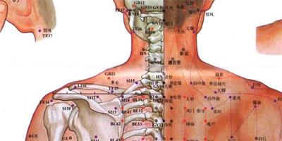 後頸部穴位按摩有什麼作用？ 按摩五大穴位治療頸椎病