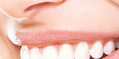 蘇打粉怎麼美白牙齒 兩大方法讓你牙齒快速白
