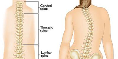 患了脊柱側彎自我矯正法有哪些？ 4大方法教你矯正脊柱