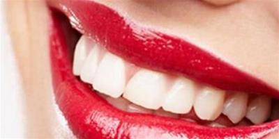 如何給牙齒去黃去黑 教你幾招讓你輕鬆擁有白白的牙齒