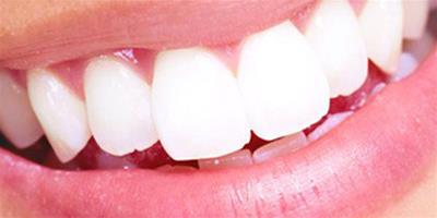 洗牙能洗掉牙垢嗎？ 8大方法讓你的牙齒潔白如雪