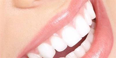 如何讓牙齒美白且無副作用呢？ 介紹美白牙齒最簡單6種方法