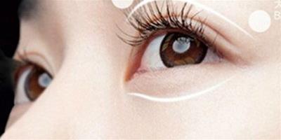 做雙眼皮手術有幾種形狀 哪種眼形才更美