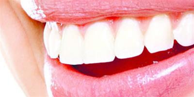 怎麼美白牙齒不傷牙呢 美白牙齒最簡單8種方法推薦