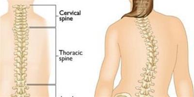 脊柱側凸檢查方法有哪些？ 4大方法教你矯正脊柱