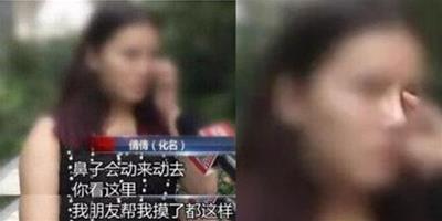 女子鼻樑能遊走 要想“不毀容”這些常識你必須知道！