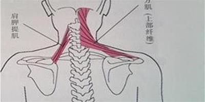 肩胛提肌損傷的症狀有哪些 該如何治療肩胛提肌損傷