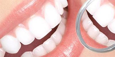 如何使牙齒變白快速美白牙齒方法 輕鬆綻放自信微笑